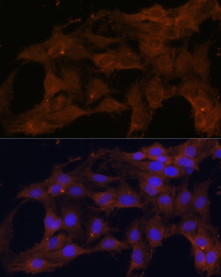 Anti-Bax Rabbit pAb