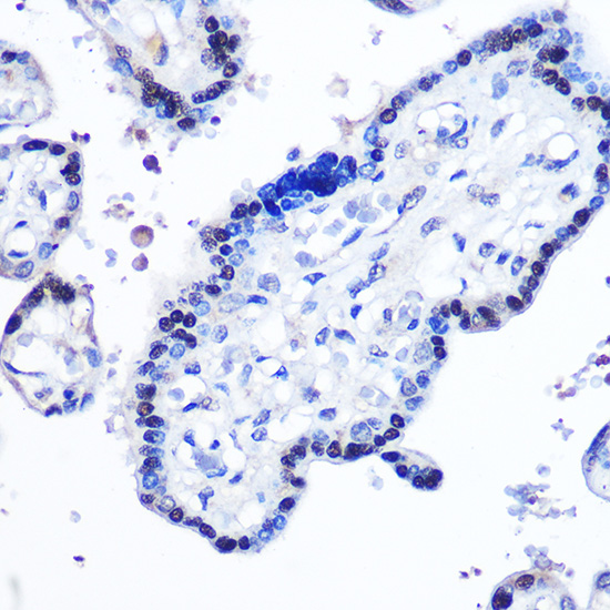 Anti-STAT5b Rabbit pAb