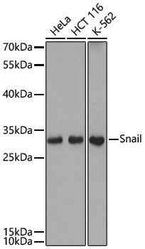 Anti-SNAI1 Rabbit pAb