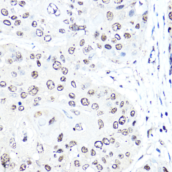 Anti-SNAI1 Rabbit pAb