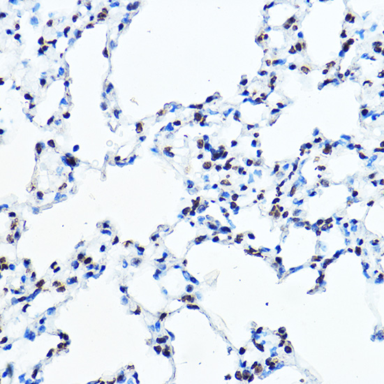 Anti-SNAI1 Rabbit pAb