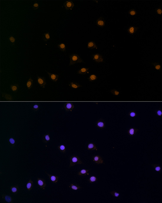 Anti-SNAI1 Rabbit pAb