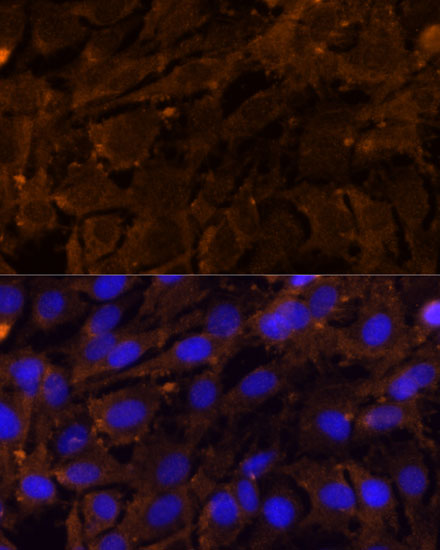 Anti-MMP3 Rabbit pAb