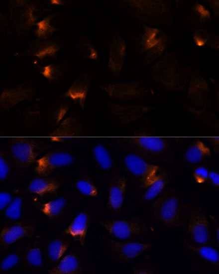 Anti-MMP3 Rabbit pAb