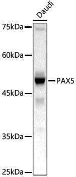 Anti-PAX5 Rabbit pAb