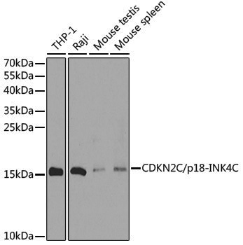 Anti-CDKN2C Rabbit pAb