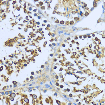 Anti-Hsp90 alpha Rabbit pAb