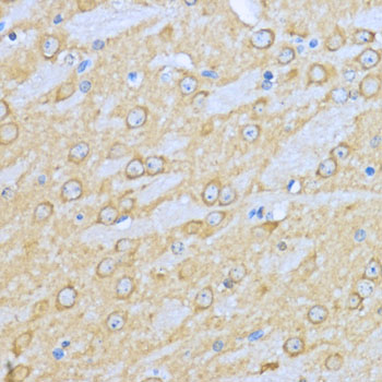 Anti-Hsp90 alpha Rabbit pAb