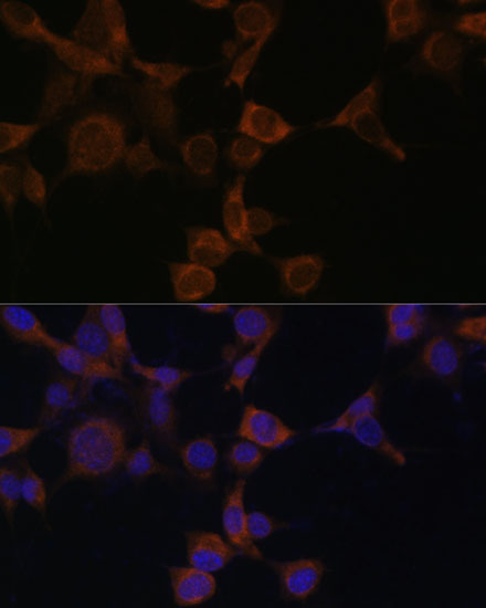 [KO Validated] Anti-AMPK beta 1 Rabbit pAb