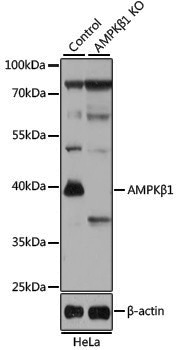 [KO Validated] Anti-AMPK beta 1 Rabbit pAb