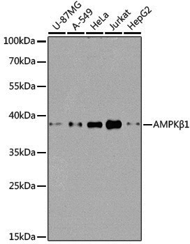 [KO Validated] Anti-AMPK beta 1 Rabbit pAb