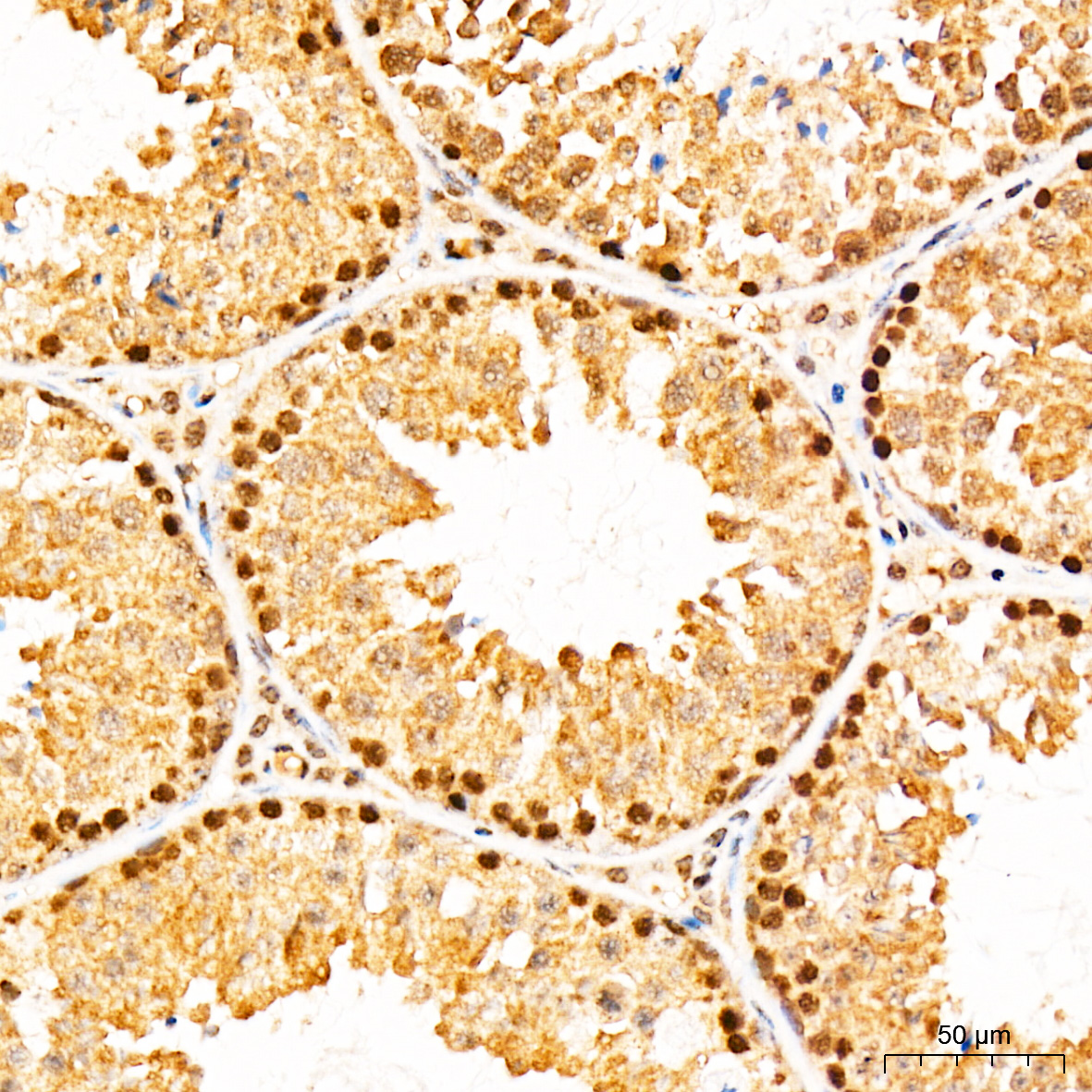 Anti-AMPK alpha 1 Rabbit pAb