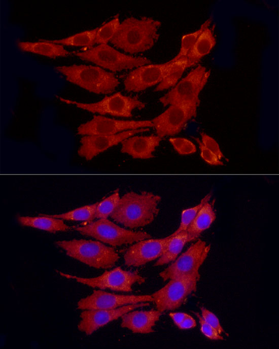 Anti-PP1C alpha Rabbit pAb