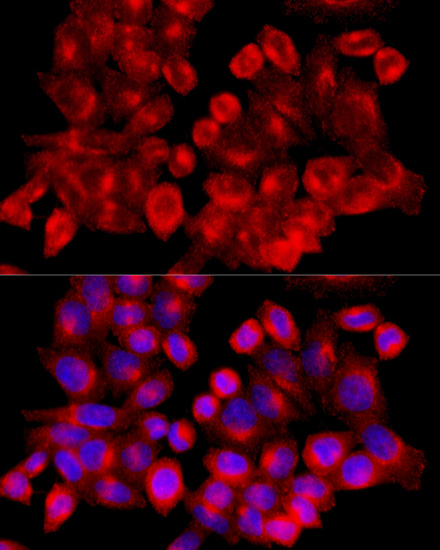 Anti-Clathrin Heavy Chain Rabbit pAb