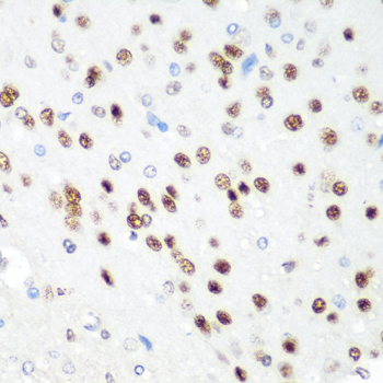 Anti-CDK1 Rabbit pAb