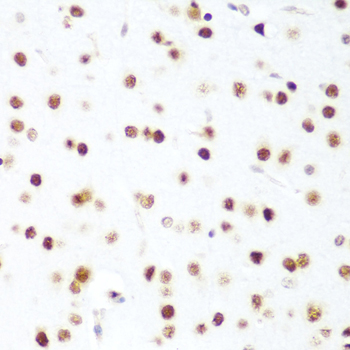 Anti-CDK1 Rabbit pAb