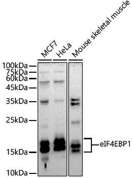 Anti-4E-BP1 Rabbit pAb