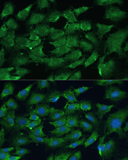 [KO Validated] Anti-SHP2 Rabbit pAb