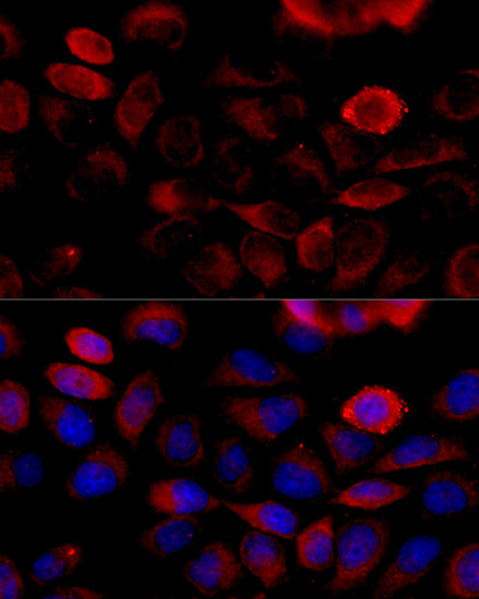 Anti-FGFR2 Rabbit pAb