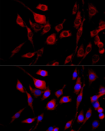 Anti-FGFR2 Rabbit pAb