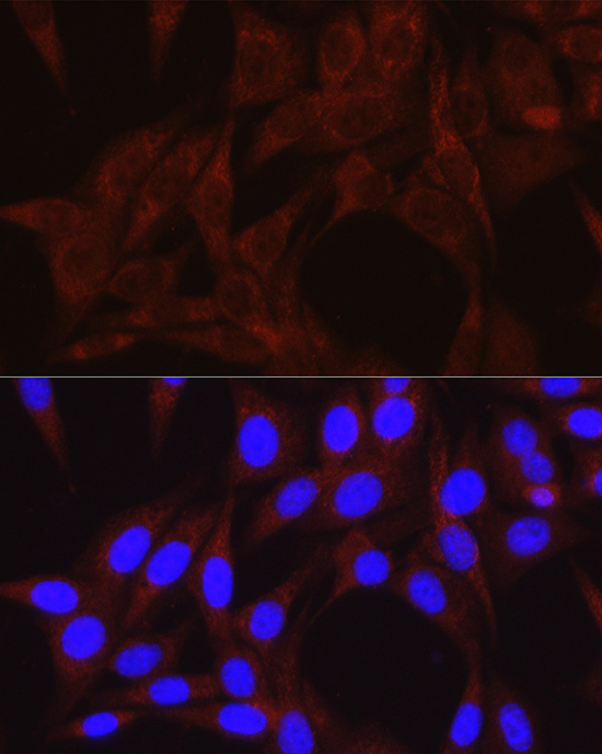 Anti-PI3 kinase p100 Rabbit pAb