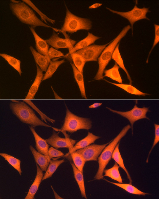 Anti-Hsp70 Rabbit pAb