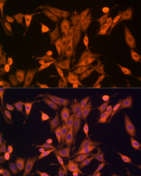 Anti-Hsp70 Rabbit pAb