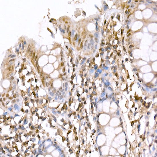Anti-AMPK alpha 1/2 Rabbit pAb