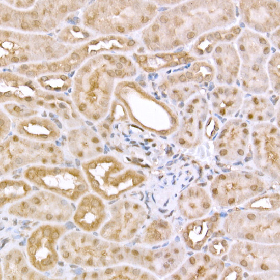 Anti-AMPK alpha 1/2 Rabbit pAb