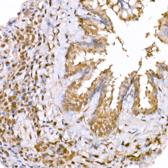 Anti-AMPK alpha 1/2 Rabbit pAb