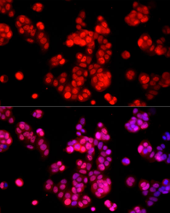 Anti-AMPK alpha 1/2 Rabbit pAb