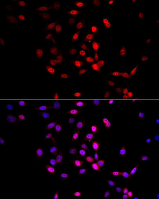 Anti-AMPK alpha 1/2 Rabbit pAb