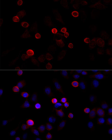 Anti-Filamin C Rabbit pAb