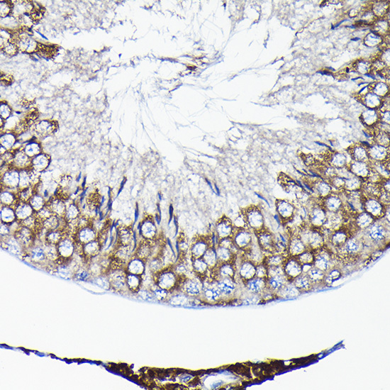 Anti-TCP 1 alpha Rabbit pAb