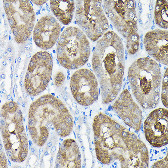 Anti-TCP 1 alpha Rabbit pAb