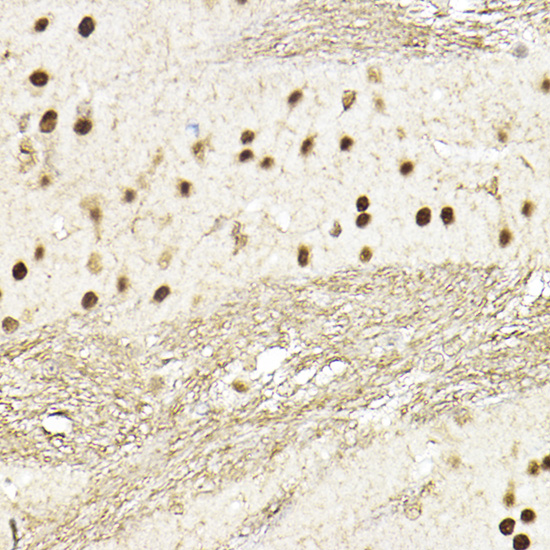 Anti-TEF1/TEAD-1 Rabbit pAb