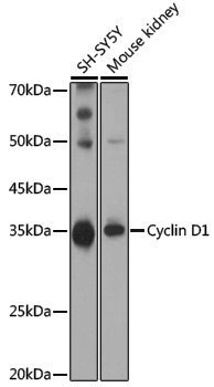 Anti-Cyclin D1 Rabbit pAb