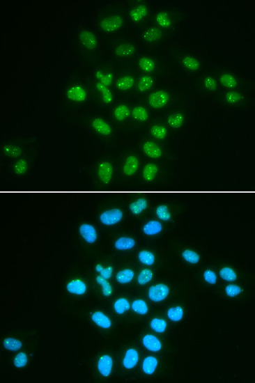 Anti-BMI1 Rabbit pAb