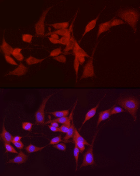 Anti-ADH5 Rabbit pAb