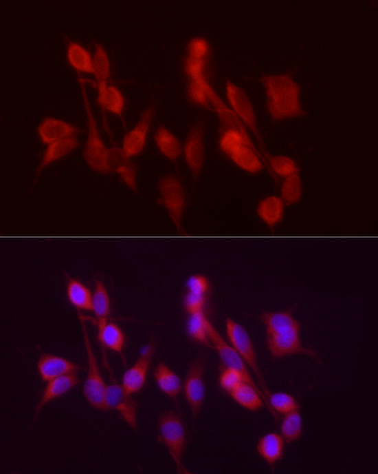Anti-ADH5 Rabbit pAb