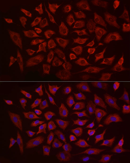 Anti-eIF4B Rabbit pAb