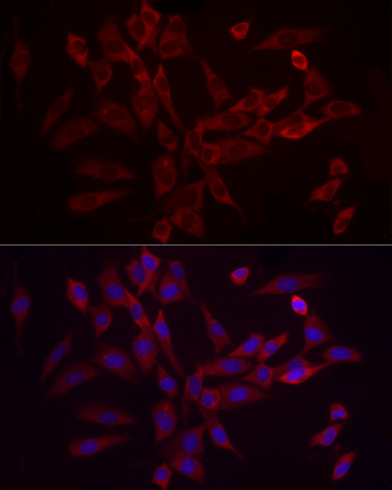 Anti-eIF4B Rabbit pAb