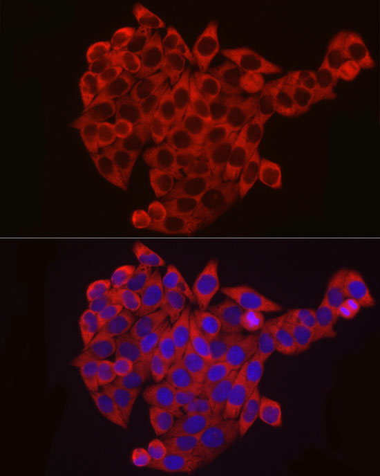 Anti-eIF4B Rabbit pAb