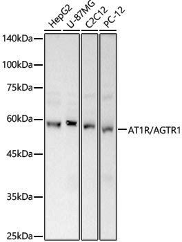 Anti-Angiotensin II Type 1 Receptor Rabbit pAb