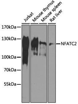 Anti-NFATC2 Rabbit pAb