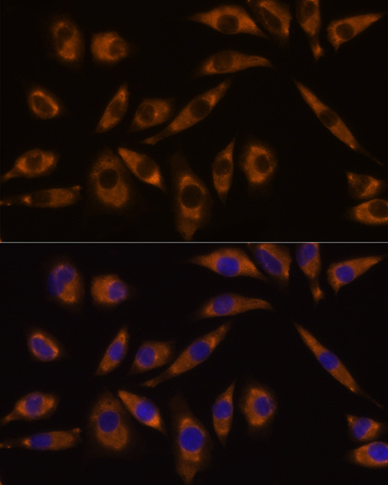 Anti-GNAQ Rabbit pAb