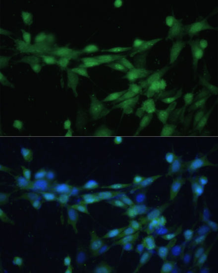 Anti-Casein Kinase 2 beta Rabbit pAb
