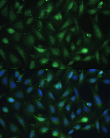 Anti-Casein Kinase 2 beta Rabbit pAb