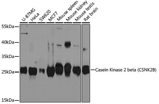 Anti-Casein Kinase 2 beta Rabbit pAb