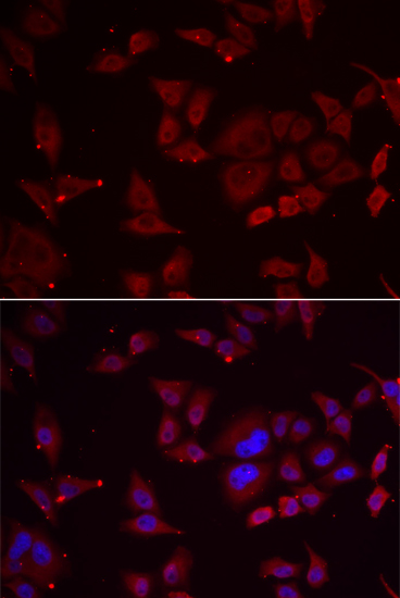 Anti-PFKFB3 Rabbit pAb